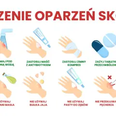 Porady dotyczące leczenia oparzeń skóry: chłodna woda, maść z antybiotykiem, zimny kompres, leki przeciwbólowe, aloes. Unikaj masła, jajka, pasty do zębów, lodu. Nie przekłuwaj pęcherzy.