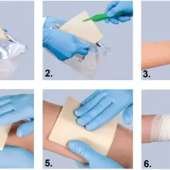 Instrukcja użycia hemostatyków: wyjęcie z opakowania, aplikacja na ranę, dociskanie i bandażowanie.