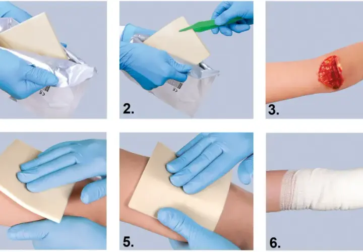 Instrukcja użycia hemostatyków: wyjęcie z opakowania, aplikacja na ranę, dociskanie i bandażowanie.