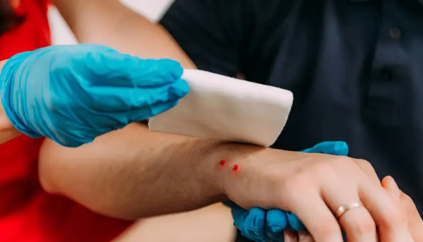 Opatrywanie rany po ukąszeniu żmii na przedramieniu. Dwie czerwone ranki z widocznymi śladami ugryzienia.