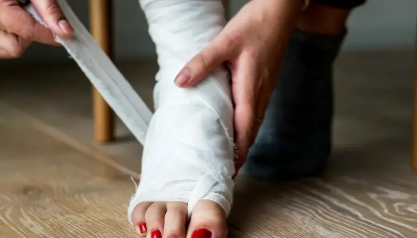 Osoba bandażuje stopę, co może być objawem skręconej kostki. Widoczne są palce z czerwonym lakierem.