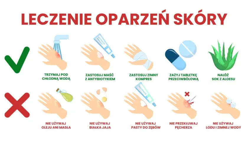 Ilustracja przedstawia zalecenia dotyczące leczenia oparzeń skóry: chłodzenie wodą, maść z antybiotykiem, zimny kompres, tabletki przeciwbólowe, sok z aloesu oraz czego nie robić: nie używać oleju, masła, białka jaja, pasty do zębów, nie przekłuwać pęc...