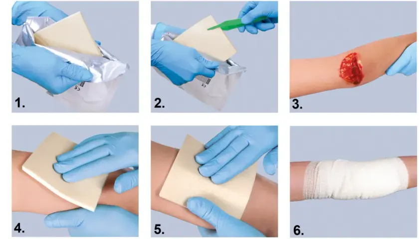 Instrukcja użycia hemostatyków: wyjęcie z opakowania, aplikacja na ranę, dociskanie i bandażowanie.