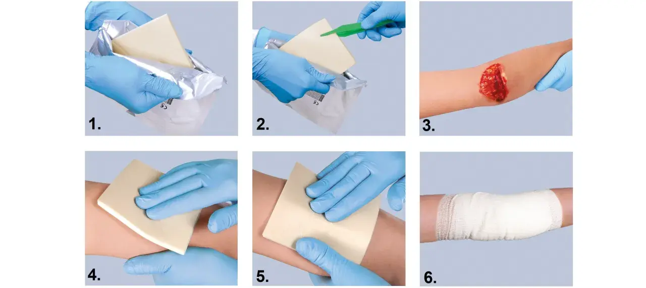Instrukcja użycia hemostatyków: wyjęcie z opakowania, aplikacja na ranę, dociskanie i bandażowanie.