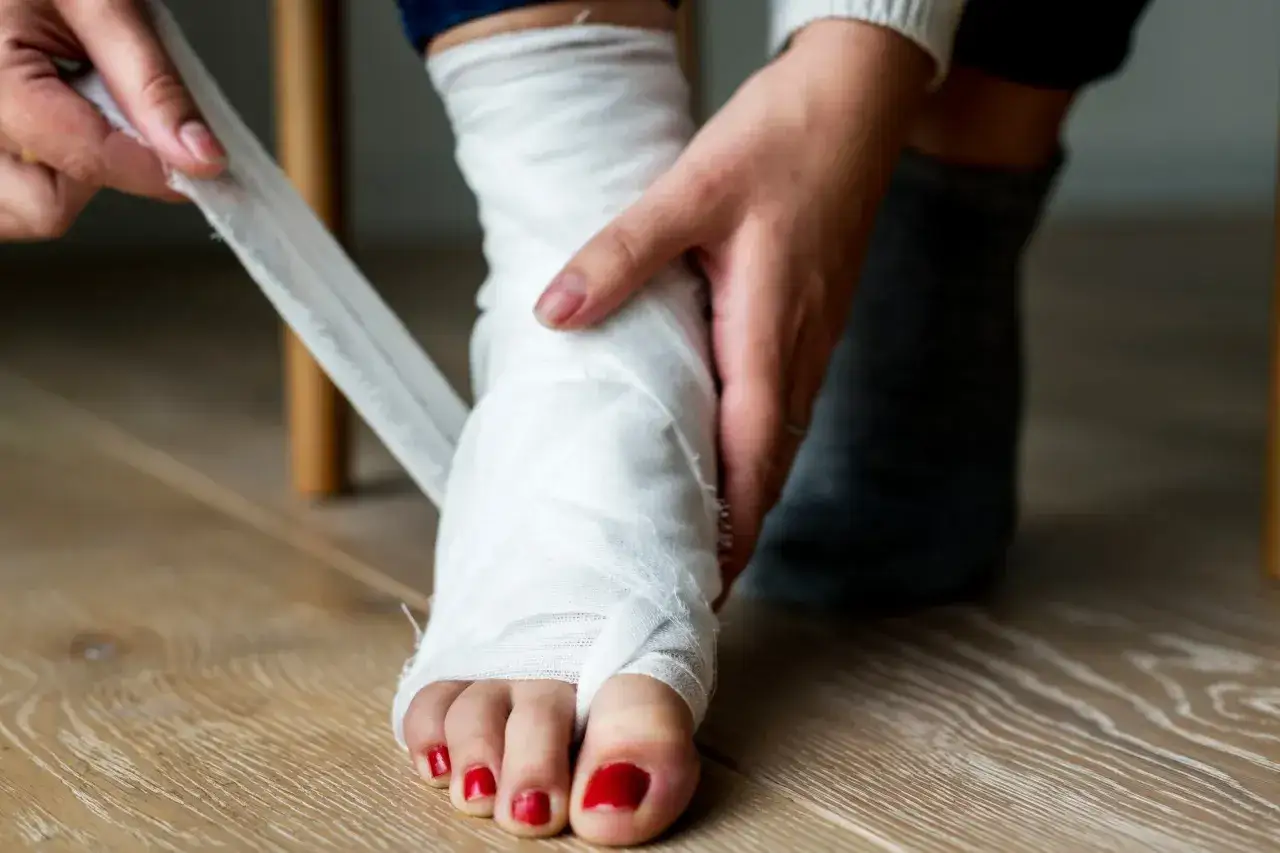 Osoba opatruje bandażem stopę po skręceniu kostki. Czerwone paznokcie u stóp kontrastują z białym bandażem.