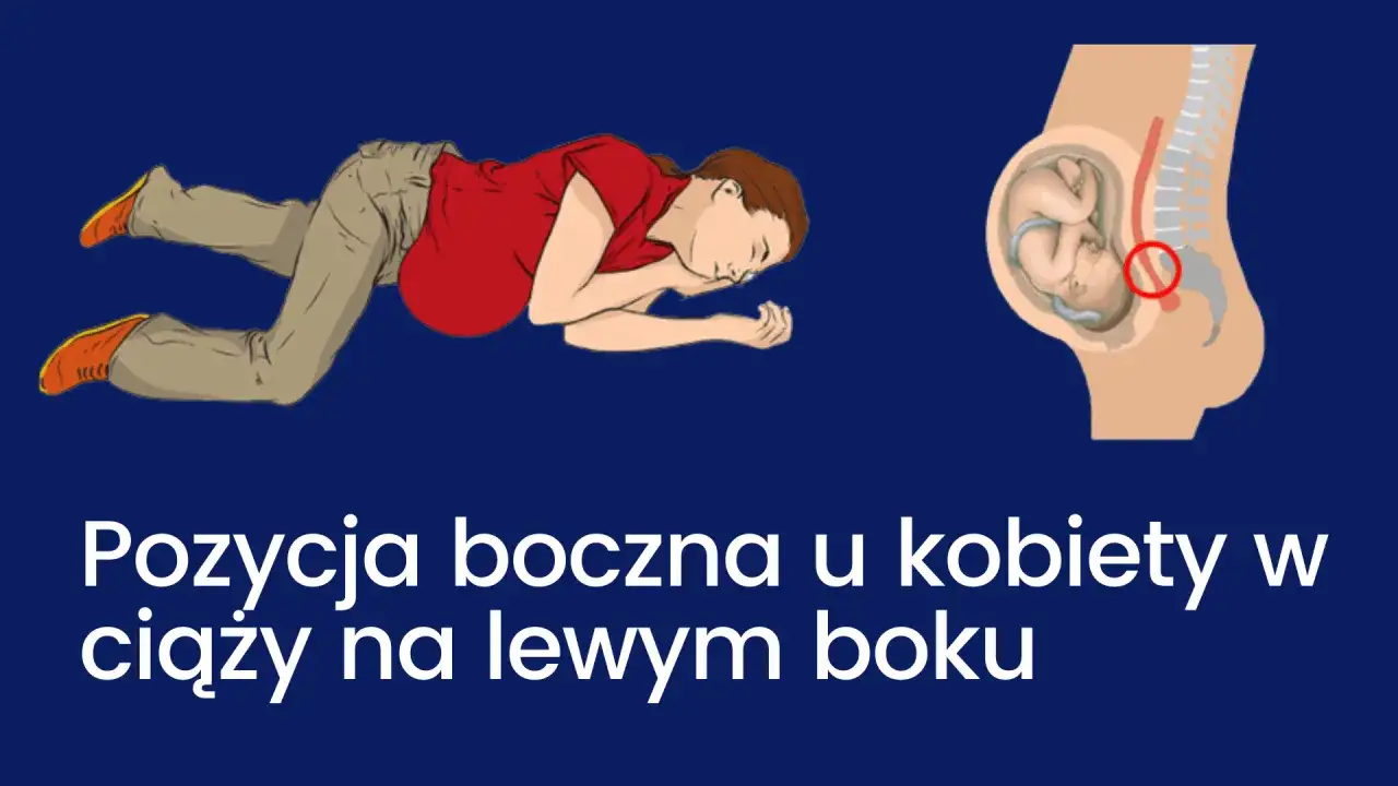 Zdjęcie Jak ułożyć kobietę w ciąży w pozycji bezpiecznej dla jej zdrowia