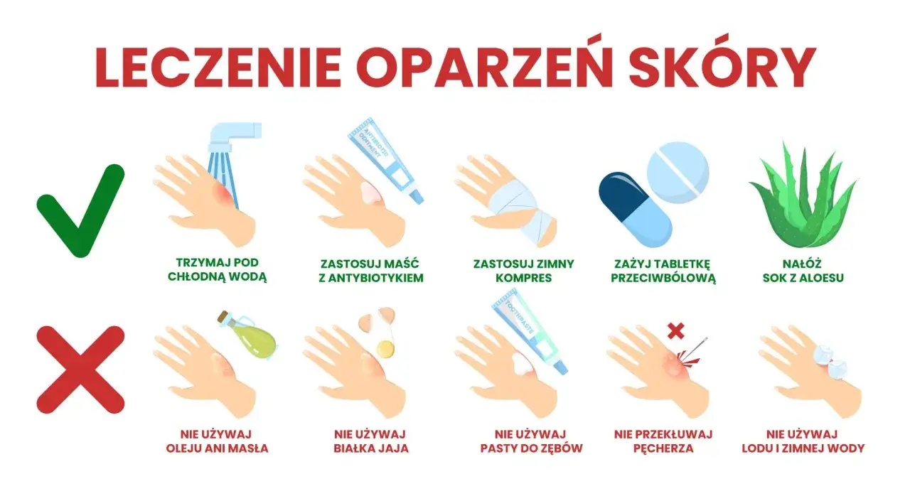 Porady dotyczące leczenia oparzeń skóry: chłodna woda, maść z antybiotykiem, zimny kompres, leki przeciwbólowe, aloes. Unikaj masła, jajka, pasty do zębów, lodu.